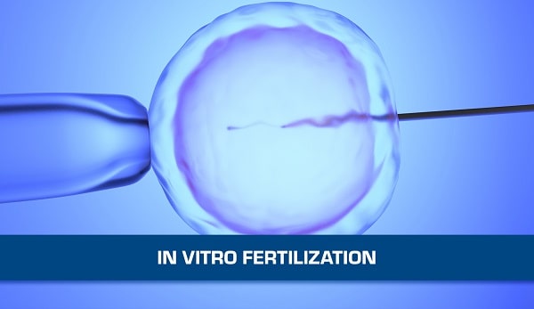 CO2 Incubator in In Vitro Fertilization